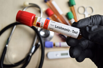 Leishmania - Test with blood sample in black gloved hands. healthcare or Medical concept