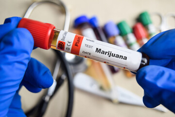 Marijuana - Test with blood sample in blue gloved hands. healthcare or Medical concept