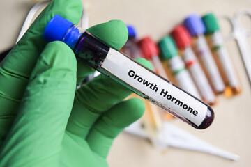 Growth Hormone - Test with blood sample in green gloved hands. healthcare or Medical concept