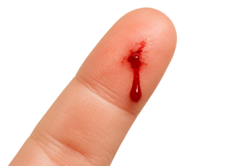 Bleeding finger injury isolated on transparent background