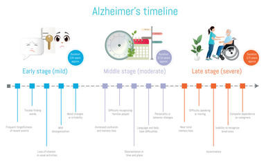 Alzheimer's disease timeline showing progression from early to late stage