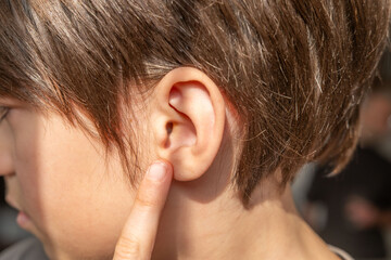 Close-up detail young male ear, poor hearing, Ear Discomfort, sound wave, Hearing Test, ringing or...