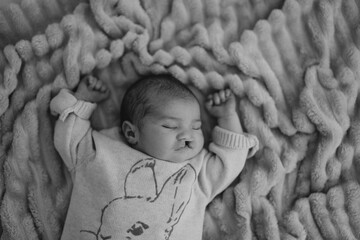 A sleeping newborn baby with congenital defect of cleft lip and palate wrapped in a cozy blanket, resting peacefully in a crib. The baby has a serene expression