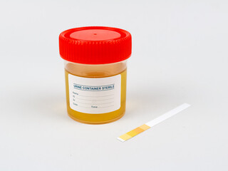 Urine sample in a sterile container, with test strips and a color chart