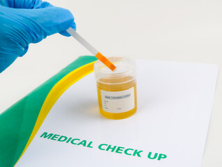 Urine sample in a sterile container, with test strips and a color chart