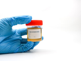Gloved hand holding a sterile urine sample container with a red lid.