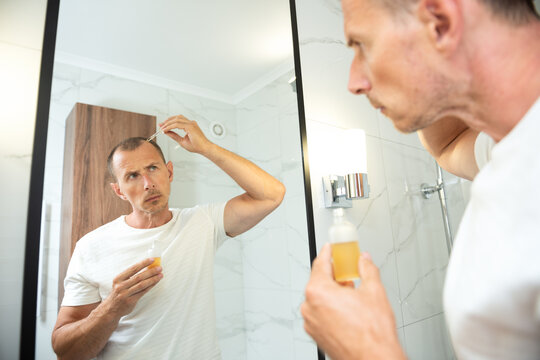 Hair loss person with serum peptide or minoxidil. Balding man head close-up. Hairloss and alopecia concept