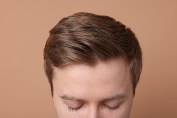 Man after hair loss treatment on beige background, closeup