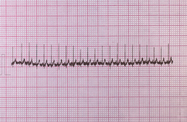 Paper cardiogram of the heart. Electrocardiogram of the heart on paper with red cells
