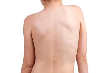 Detail of the baby's back.