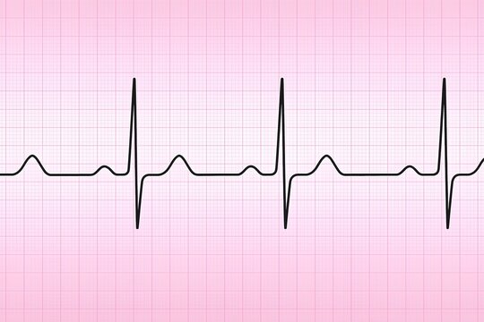 illustration of normal ekg waveform on a pink medical graph paper background, perfect for cardiology visuals, heart health education, and clinical presentations