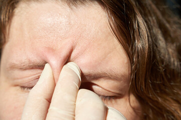 Female caucasian adult suffering from headache pinching forehead in close-up medical examination.