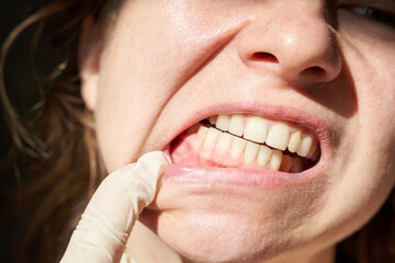 Close-up of caucasian female adult checking teeth with gloved hand in natural lighting.
