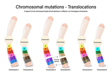 Translocations. Chromosomal mutations. Various genetic disorders. Alteration of chromosome structure. Vector used for scientific and medical education. 