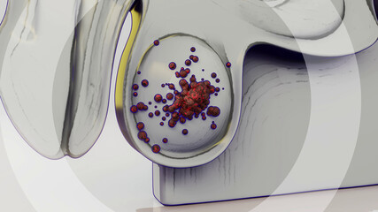 Conceptual 3D illustration of testicular cancer
