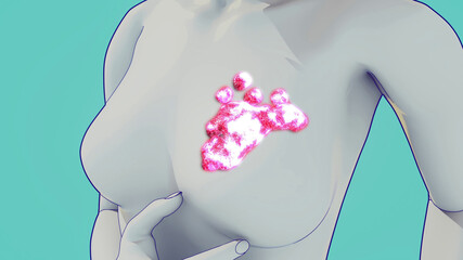 Conceptual Woman with breast cancer
