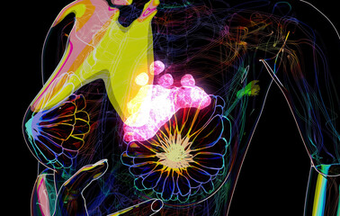 Conceptual Woman with breast cancer