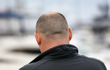 A bald man with a shaved head is looking at the camera