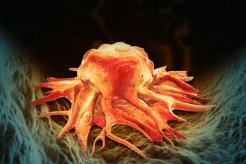 Cancer cells. Cancer outbreak and treatment for malignant cancer cells in a human body. 3d illustration