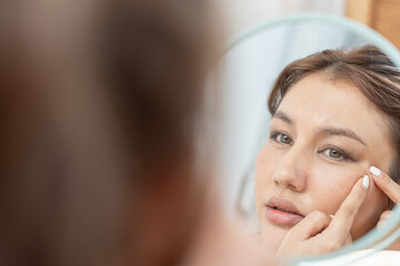 Woman worried about face Dermatology, rosacea dermatitis, allergic steroids, sensitive skin, red...