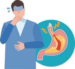 逆流性食道炎の男性