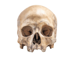 Human Skull Frontal View - Detailed Anatomy of a Craniotomy Specimen