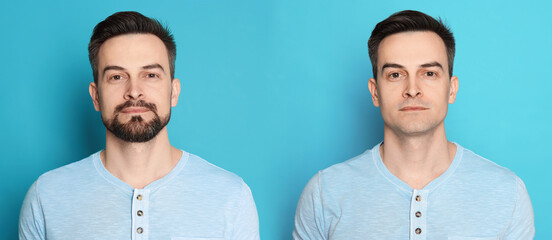 Handsome man before and after shaving on light blue background, collage of photos. Banner design