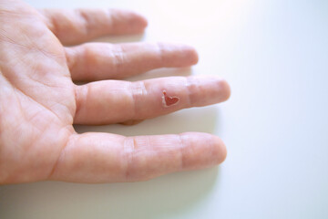 Detailed close-up of a woman's finger with a heart-shaped wound. The image captures the delicate...