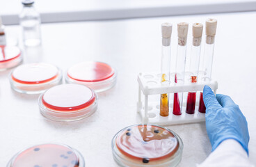 Microbiology hand medical working on agar plate culture bacteria and drug resistance of pathogens...