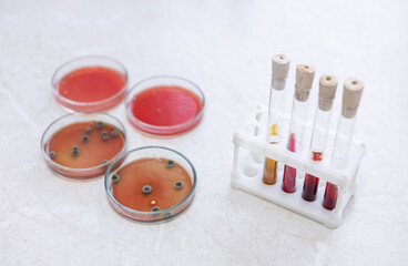petri dish with agar and bacteria. At background blurred, biotechnological laboratory. Hand in...