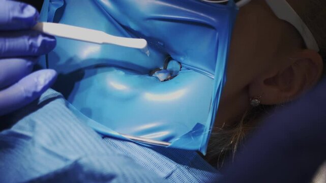 This dental procedure utilizes a rubber dam for effective protection during treatments