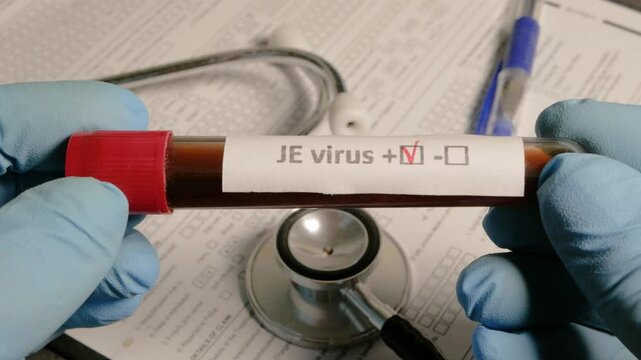 Doctor holding positive japanese encephalitis virus blood test tube