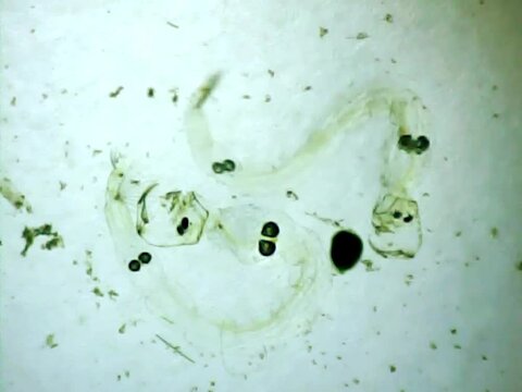 Phantom midege larvas on a microscope glass