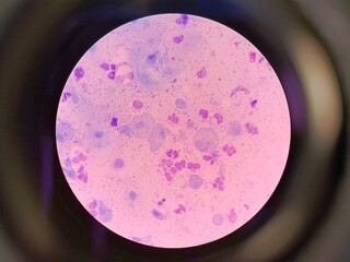 Trichomonas Under Microscope — Protozoan Parasite Causing Trichomoniasis