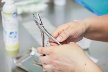 A medical professional's hands carefully hold a sterile, polished stainless steel surgical instrument, highlighting meticulous preparation and essential care in a clinic