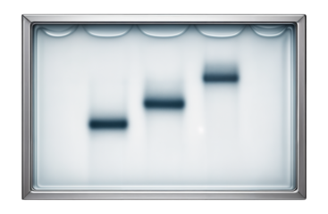 Gel electrophoresis band pattern showing three distinct alleles for a gene