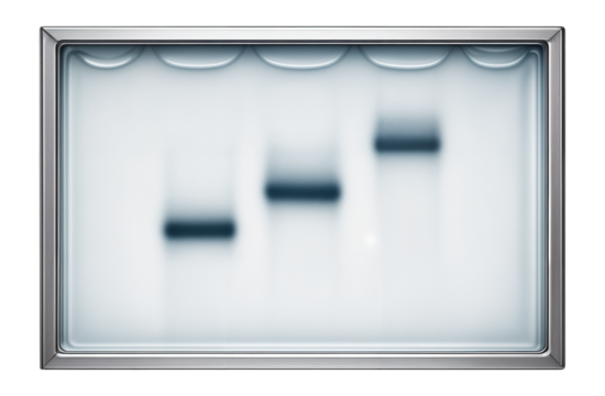 Gel electrophoresis band pattern showing three distinct alleles for a gene