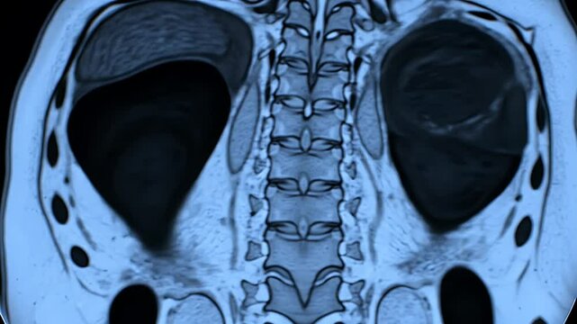 Magnetic Resonance Imaging Scan Visualization of Human Abdomen Showing Internal Organs Spine and Kidney Medical Educational Visual