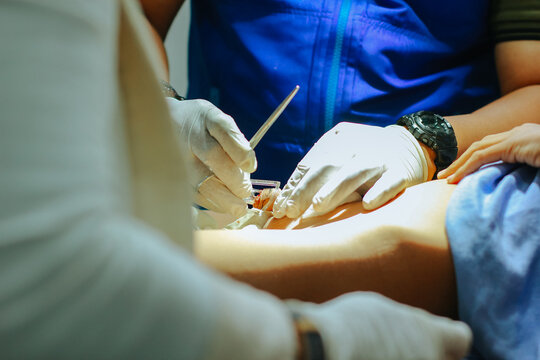 doctor operating on child, Circumcision on child