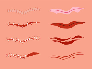 A collection of vector illustrations depicting various types of human skin wounds including scratches scrapes abrasions