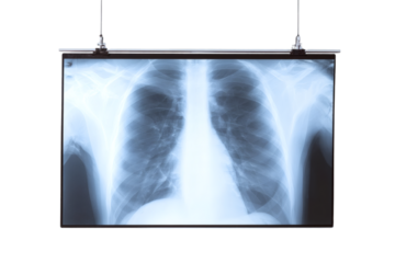 Radiographic film displays chest anatomy and provides a detailed lung examination, essential for diagnostics and pulmonary health assessment, transparent background