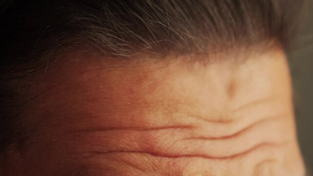 A man's forehead wrinkles. The man is surprised by raising her eyebrows. High quality 4k footage