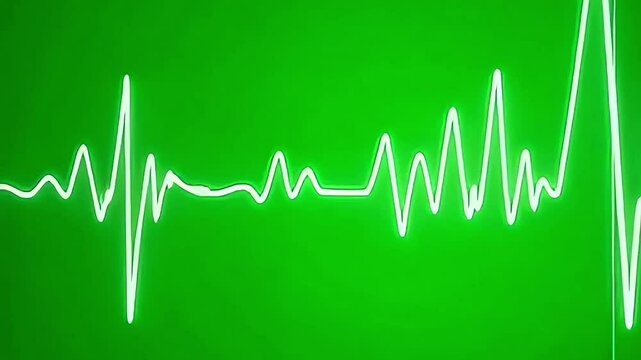 Heart beat rhythm graph on green screen, Generative AI
