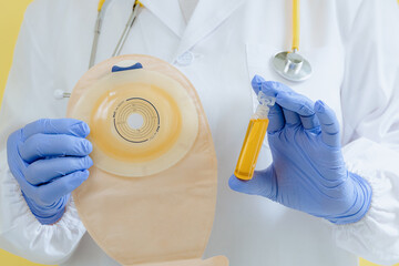 One doctor holds a colostomy bag and a bottle of medicine.