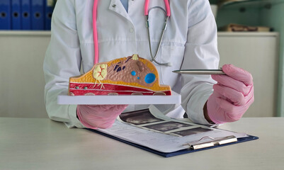 A doctor showing a breast tumor or cancer on anatomical model of the breast educate women about the...