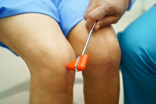 Asian doctor knock on knee reflex nerve for check and treatment senior patient in hospital. - Powered by Adobe