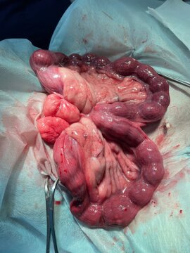 A veterinarian operates a dog for purulent peritonitis and pyometra of the dog's uterus. Endometriosis, frozen pregnancy, abortion