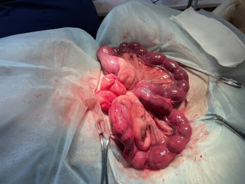 A veterinarian operates a dog for purulent peritonitis and pyometra of the dog's uterus. Endometriosis, frozen pregnancy, abortion