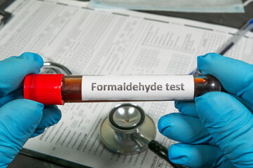 Scientist holding formaldehyde test tube in laboratory setting
