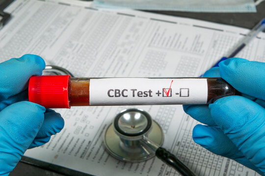 Doctor holding cbc test tube with positive result in laboratory